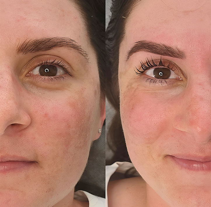 Eyelash-lift-heading